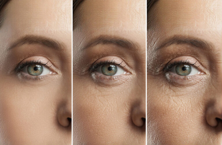 What You Need to Know About Aging Skin